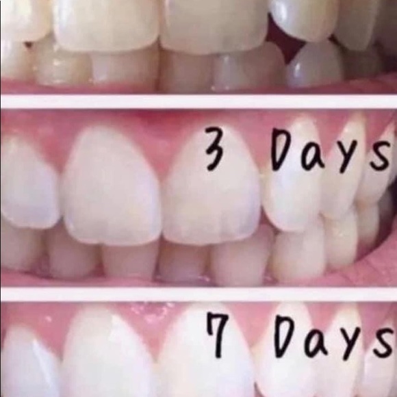 The best whitening toothpaste I have ever used!!! - Picture 2 of 7